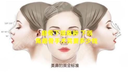 磨骨下颌角肿 下颌角磨骨手术需要多少钱